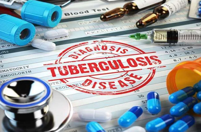 ہندوستان میں ۲۰۲۴ء میں عالمی سطح پر ٹی بی کے سب سے زیادہ معاملات: ڈبلیو ایچ او