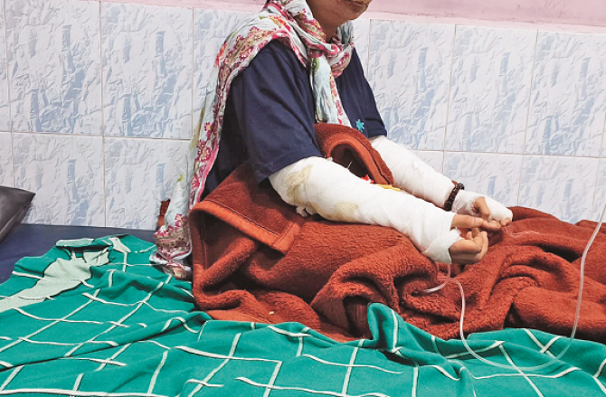 کچن سے چھپکلی بھگانے کیلئے اسپرے استعمال کرنے پر میاں بیوی جھلس گئے
