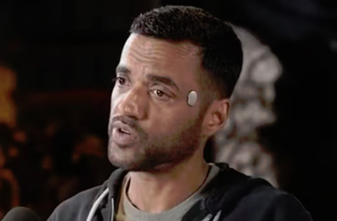 زوماٹو کے بانی گوئل نے کنپٹی پر ’ٹیمپل ‘ آلہ لگاکر نئی بحث چھیڑ دی  