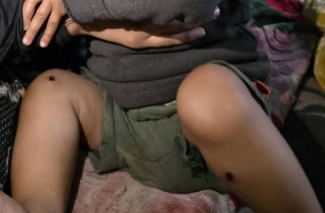 اسرائیلی فوجیوں نے ۱۸؍ ماہ کے بچے کو تشدد کا نشانہ بنایا