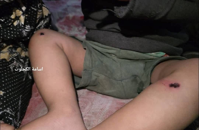 اسرائیلی فوجیوں نے ۱۸؍ ماہ کے بچے کو تشدد کا نشانہ بنایا