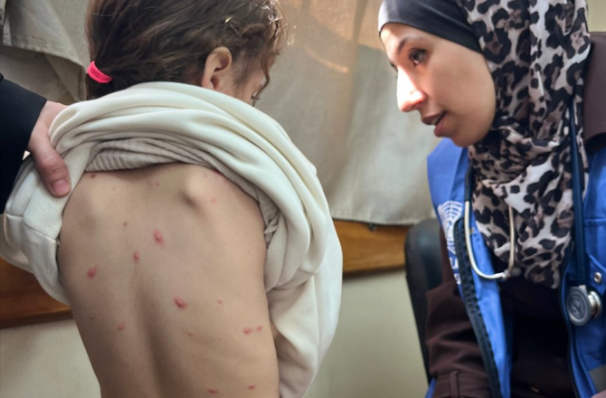 غزہ: اقوام متحدہ کے مطابق چوہوں اور کیڑوں کے سبب جلد کے انفیکشن میں اضافہ