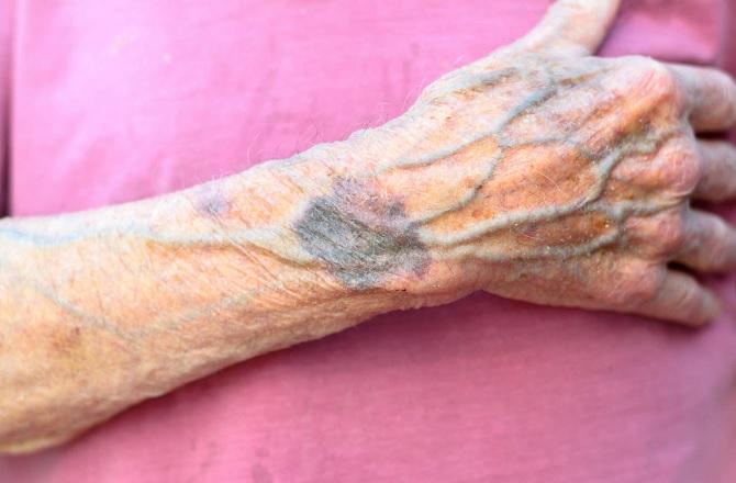 Symbolic image. Photo: INN