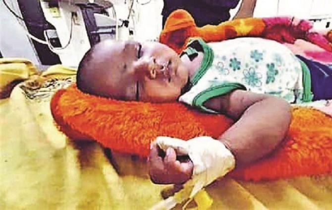 A child is being treated at a hospital in Patna. P.Picture:INN