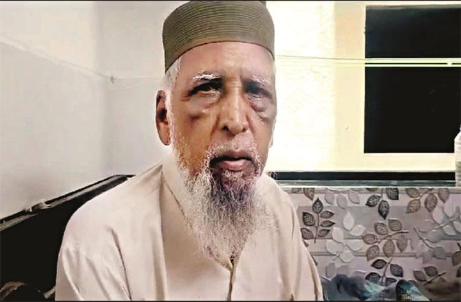 Ashraf Ali Syed Hussain who was beaten up by miscreants