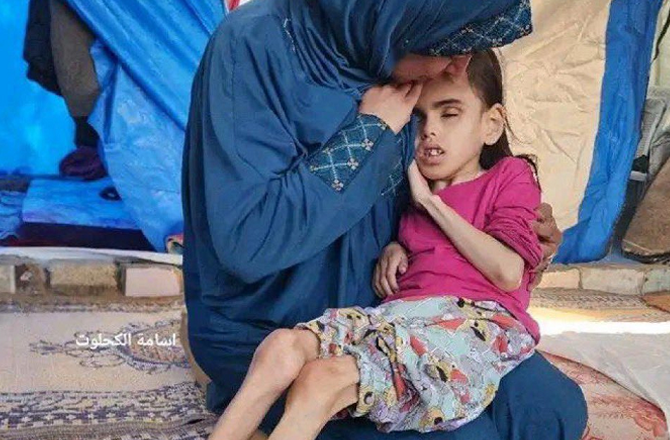 The humanitarian crisis in Gaza has reached “unimaginable levels.” Photo: X