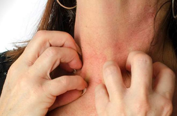 <div><strong>زیورات سے ہونے والے ریشز کیلئے</strong></div>
<div>اگرمصنوعی زیورات پہننے کے بعد خارش محسوس ہوتی ہے تو انہیں پہننے سے پہلے ویسلین لگائی جائے تو یہ جلد پر رکاوٹ کا کام کرے گا اور دانوں سے بچائے گا۔</div>
<p>&nbsp;</p>