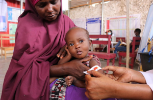 صومالیہ: غذائی قلت کے شکار بچے ایران جنگ سے شدید متاثر 