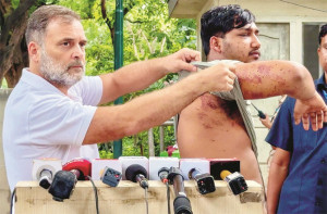 راہل گاندھی پیلٹ گن سے زخمی ہونے والے طالب علم کو سامنے لائے