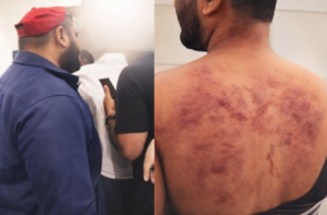 پونے: نوجوانوں کی نجی افطار تقریب میں شر پسندوں کی مداخلت، ہتھیاروں سے حملہ 